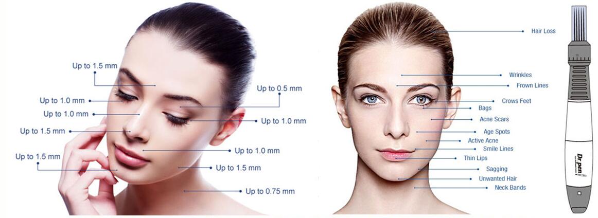 Dr Pen Ultima A1 Wired Microneedling Derma Pen